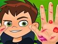 게임 Ben10 핸드 닥터  온라인