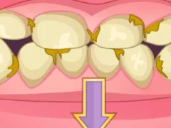 게임 Bad Teeth Makeover 온라인