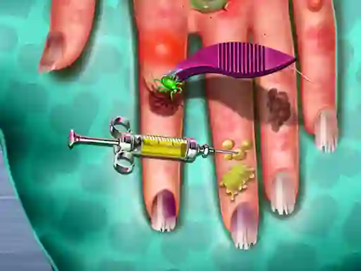 게임 Hand Skin Doctor 온라인