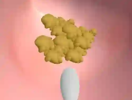 게임 Earwax Clinic 온라인