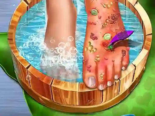 게임 Feet Skin Doctor 온라인