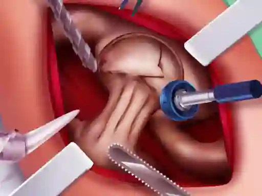 게임 Princess Hips Surgery 온라인